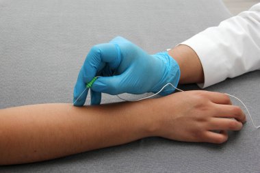 Electromyography is a graphic recording technique of the electrical activity of the muscles known as electromyogram or EMG, it is monitored through intramuscular electrodes