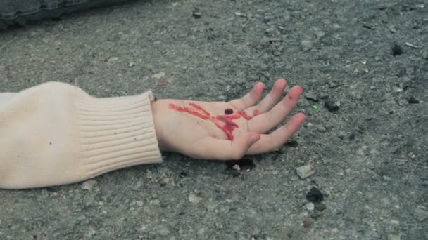 Blut Der Handfläche Erschien Nach Einem Autounfall Nahaufnahme Wundschaden — Stockvideo