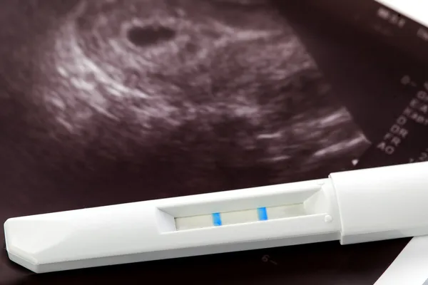 Pregnancy test and ultrasound mother's womb — Stock Photo, Image