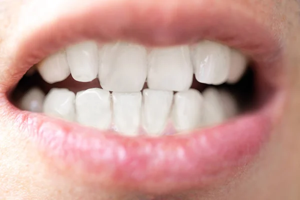 Άνθρωπος Καθαρά Λευκά Δόντια Λεύκανση Δοντιών Οδοντιατρική Περίθαλψη Έννοια — Φωτογραφία Αρχείου