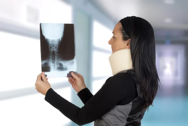 Mulher com colar cervical olhando sua radiografia — Fotografia de Stock