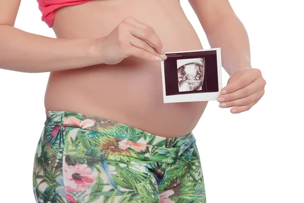 Glada gravid kvinna med en ultrasond av hennes baby kvinna — Stockfoto