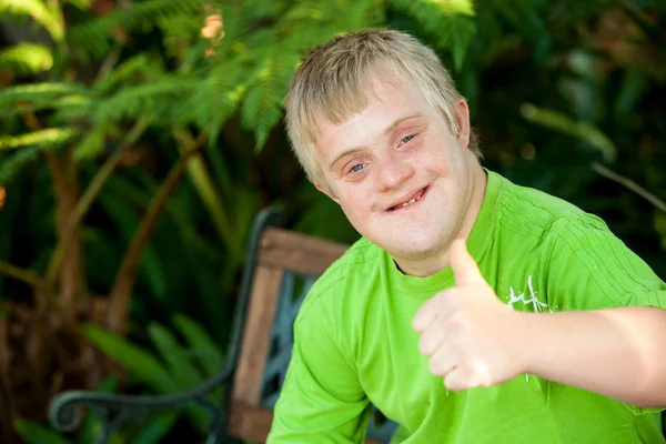 Cute handicapped boy showing thumbs up outdoors. — Stock Photo, Image