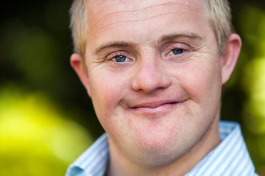 yakışıklı bir özürlü çocuğun yüz vuruş.