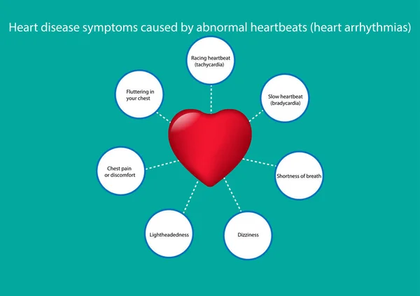 心律失常引起的心脏病症状 病媒图解 — 图库矢量图片
