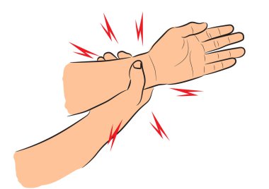 Kırık veya burkulmuş Bilek Diyagramı vektör çizimi izole edilmiş beyaz arkaplan