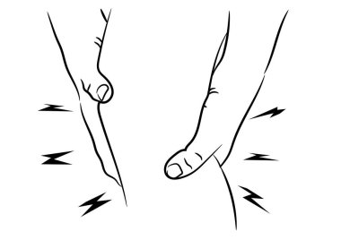Tendon diz eklemi sorunları ağrılı, egzersiz vektör illüstrasyon sonra şişme