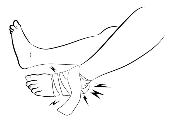 Лодыжка Повязка Ligament Поврежденной Лодыжке Графический Дизайн Векторной Иллюстрации Белом — стоковый вектор