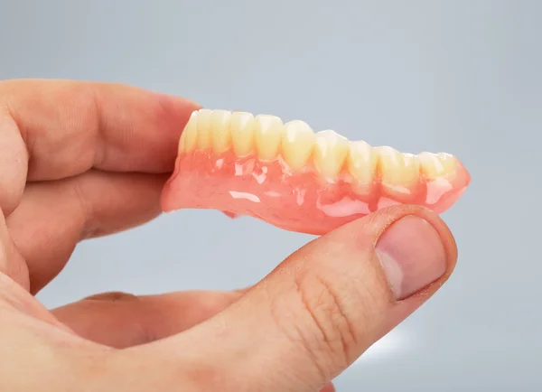 Mão segurando um conjunto de dentaduras — Fotografia de Stock