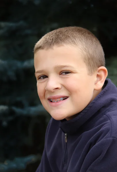 Boy with new team color braces — Stock Photo, Image