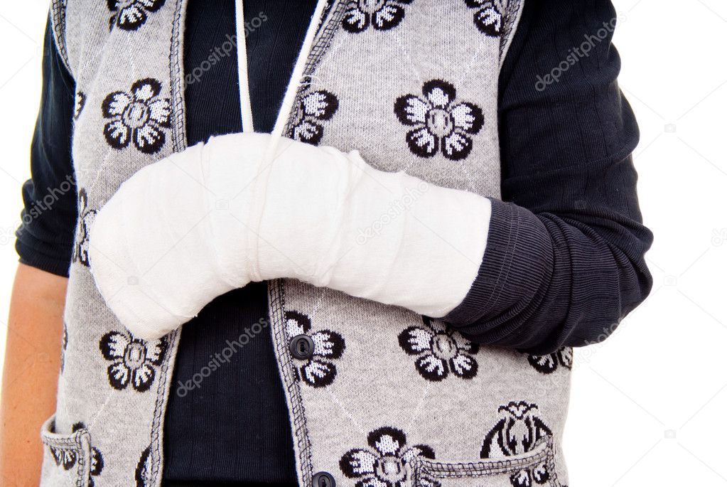 A woman with a broken arm