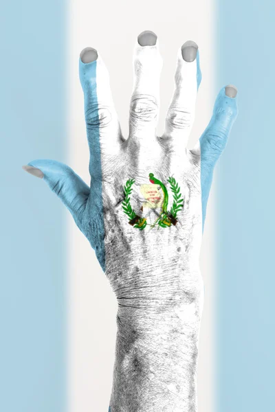 Hand einer alten Frau mit Arthritis — Stockfoto