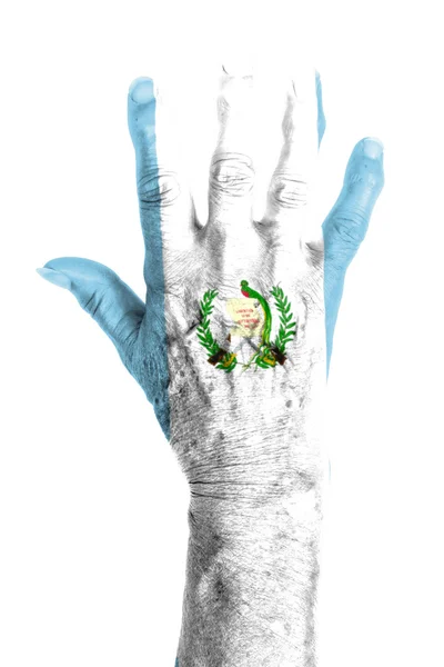 Hand einer alten Frau mit Arthritis — Stockfoto