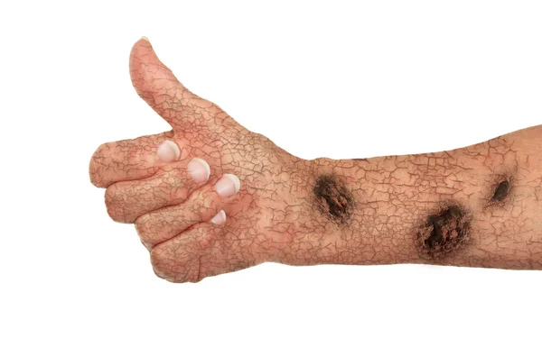 Старая рука с трещинами и ржавчиной, концепция старения, дающая возможность — стоковое фото