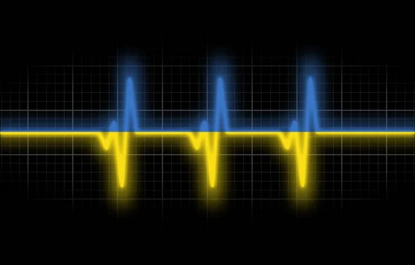 Oekraïense Hartslag Geïsoleerd Zwarte Achtergrond — Stockfoto