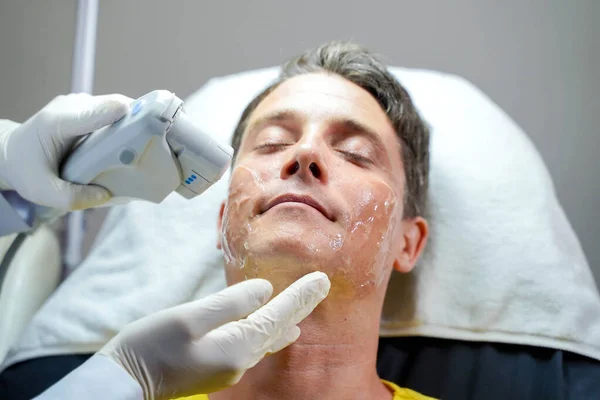 피부를 자극하기 치료를 잘생긴 잘생긴 남자의 얼굴을 봉합하는 — 스톡 사진