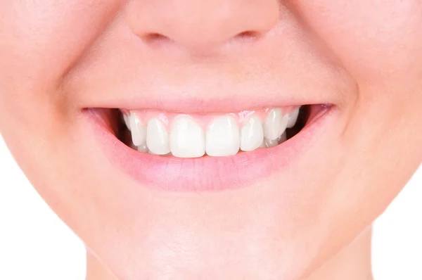 Отбеливание зубов. Стоматологическая помощь — стоковое фото