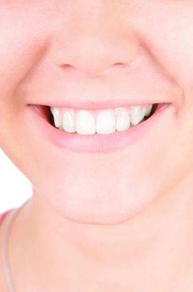 Clareamento dos dentes. Cuidados dentários — Fotografia de Stock