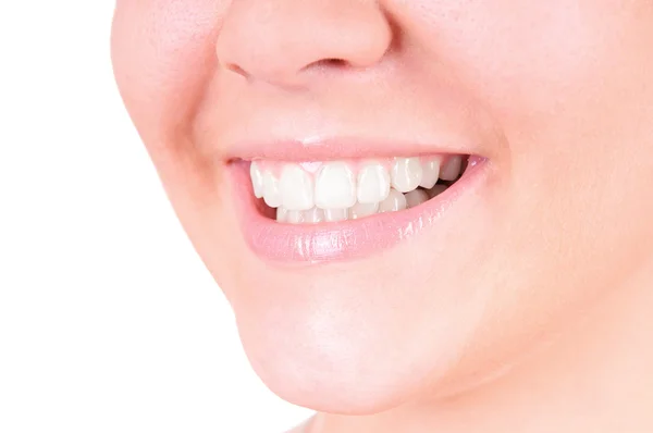 Teeth whitening. Dental care — Stock Photo, Image