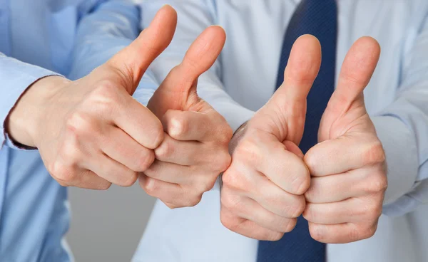 Thumbs up for success! — Stock Photo, Image