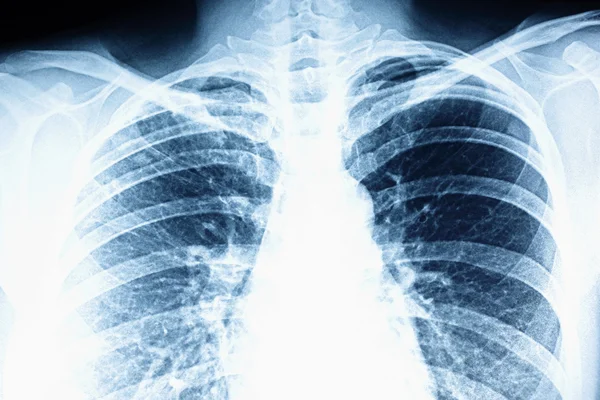 X-ray — Stock Photo, Image