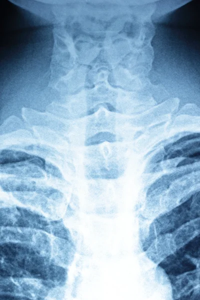 Röntgen — Stockfoto