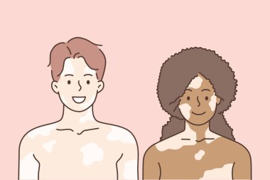 Vitiligo ve karışık ırk aşk kavramı