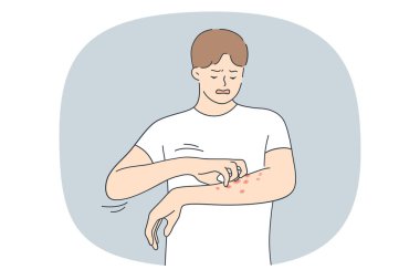 Mutsuz genç adamın kolları kaşınıyor. Vücudunda kırmızı sivilceler var. İlaca ihtiyacı var. Adam alerji ya da sedef hastalığına yakalanmış. Cilt bakımı, ilaç ve sağlık sigortası. Düz vektör illüstrasyonu. 