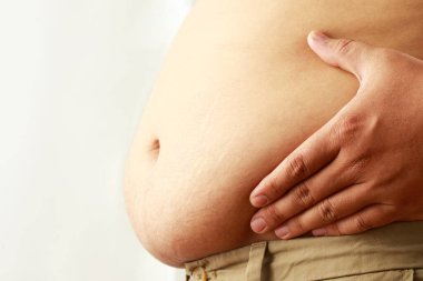 Şişman, olgun bir adam karnı şişmiş, karnı şişmiş, bembeyaz ya da obez. Kilo verme konsepti.
