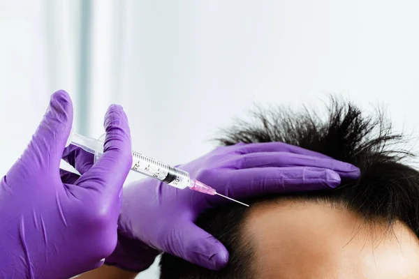 Permanent hair transplant by transplanting hair cells without surgery The wound heals quickly, leaving no scars. Suitable for people with hair loss and baldness problems.