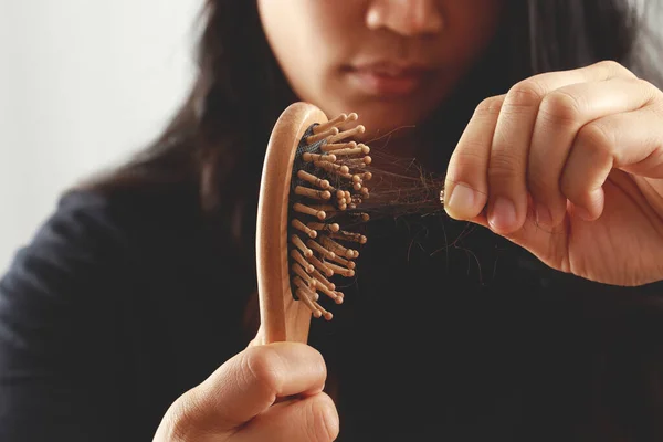 Rückansicht Junge Frau Besorgt Über Haarausfall Hormonelles Ungleichgewicht Stresskonzept Viele — Stockfoto