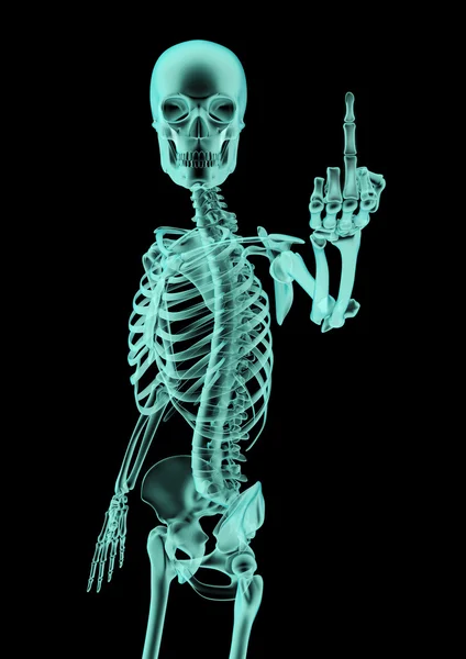 La radiografia del dito — Foto Stock