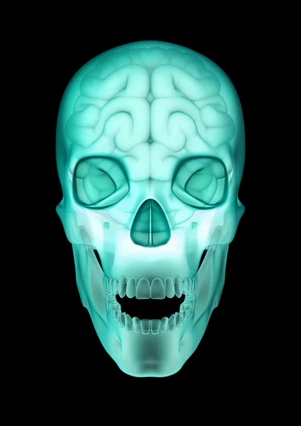 Raio X do cérebro do crânio — Fotografia de Stock