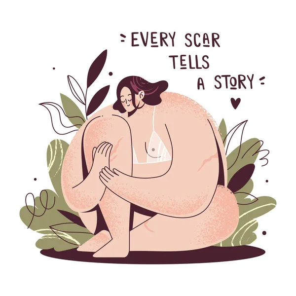 Body positive girl. Hand drawn text Every scar tells a story. Plus size woman. — Stock Vector