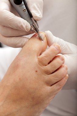 özel ekipman boyasıyla ayak tirnagi