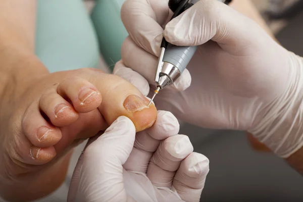 Cuidados médicos com os pés — Fotografia de Stock