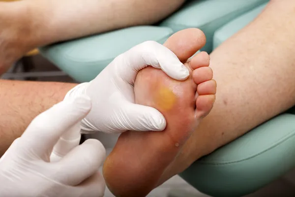 Chiropodistas limpa o pé — Fotografia de Stock