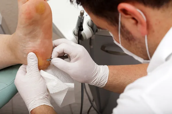 Chiropodistes travaillant avec un scalpel — Photo