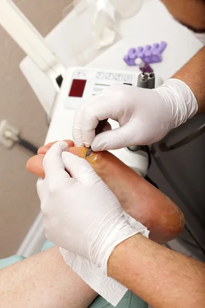 A podiatrist in the treatment — Stock Photo, Image