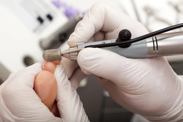 Kuru Cilt bir ayak bir öğütücü ile kaldırmak