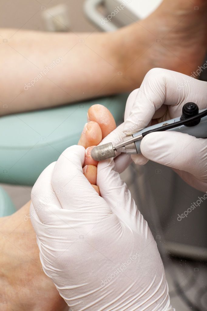 Remove dry skin with a grinder of a toe Stock Photo by ©TKphotography 42120015 Remove dry skin with a grinder of a toe Stock Photo by ©TKphotography 42120015