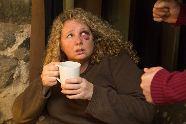 Fearful woman with black eye