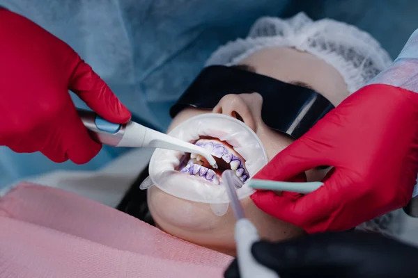 Top view of the process of brushing the patient\'s teeth. Brushing teeth with water jet and saliva remover. Retractor cheeks on the lips. The concept of professional oral hygiene. High quality photo
