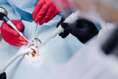 Kadınların dişlerini fırçalama süreci diş muayenehanesini kapatır. Sağlıklı diş kavramı. Kapatın. Yüksek kalite fotoğraf