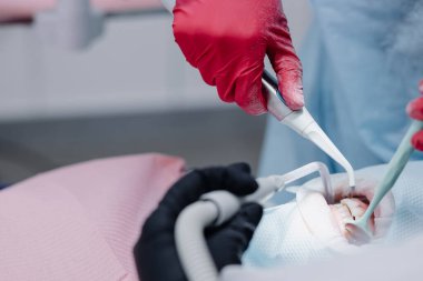  Kadın dişçilerin elleri hastaların dişlerini fırçalıyor. Yan görüş. Yüksek kalite fotoğraf