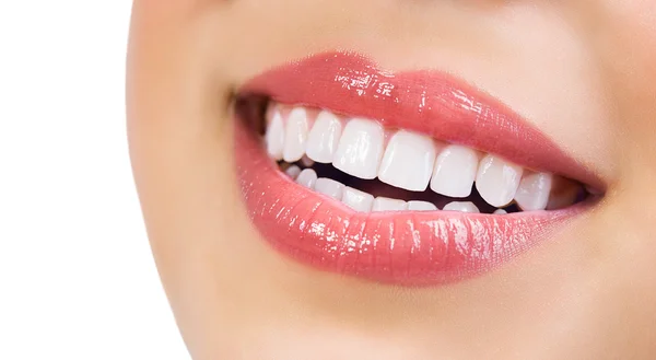 Sonrisa saludable. Blanqueamiento de dientes. Concepto de cuidado dental — Foto de Stock