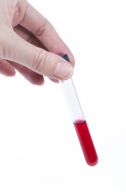 el test tüpü içinde sıvı renkli