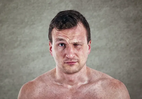 Man blinked an eye — Stock Photo, Image