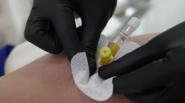 Kateter iğnesi bandı