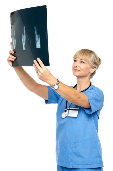 Orthopedic surgeon holding up x-ray to analyze — Stock Photo, Image